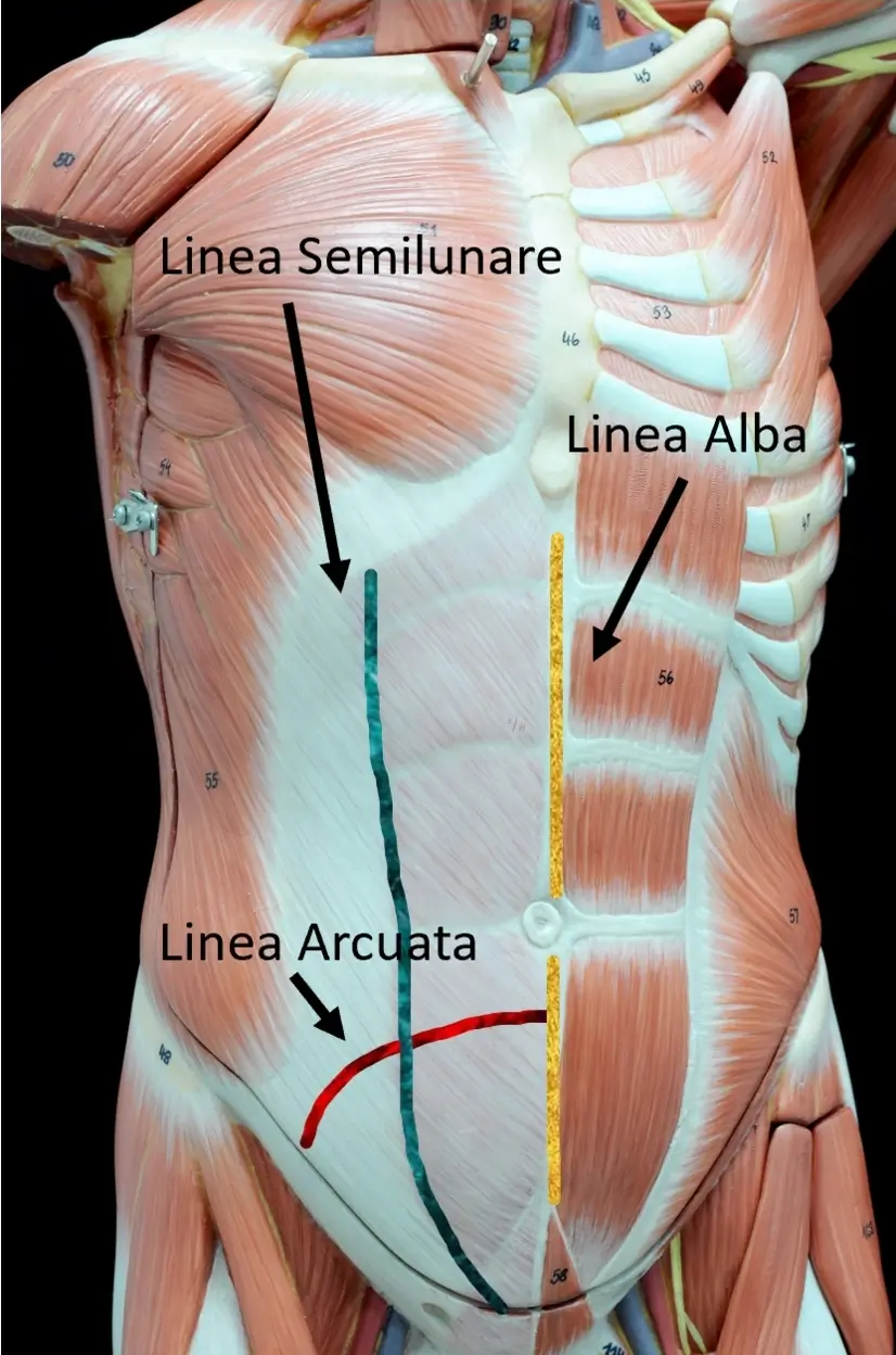 Seconda gravidanza e diastasi addominale: cosa cambia e quando intervenire — anatomia diastasi